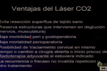 Aula do 47° | Dr. Ricardo Serrano | Tratamento das Neoplasias inicias de laringe com laser