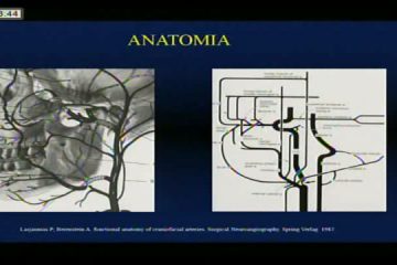 I Combined | Dr. Francisco Ferreira R. Junior | Palestra Nacional – Tratamento de tumores vascularizadosarterioscopia