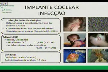 I Combined | Dr. Luiz Rodolpho Penna Lima Junior | Conduta na infecção e IC
