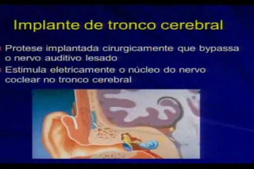 I Combined | Dr. Ricardo Ferreira Bento | Implante auditivo